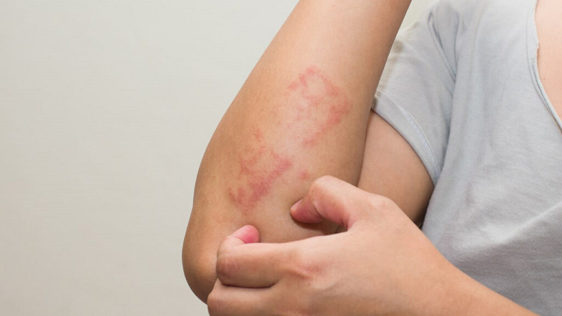 Nguy cơ khi dùng sex toy không vệ sinh