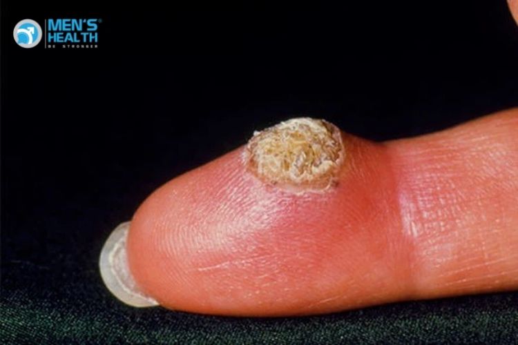 Oral Sex Là Gì? Tác Hại Ra Sao? Có Lây Bệnh Xã Hội Không?