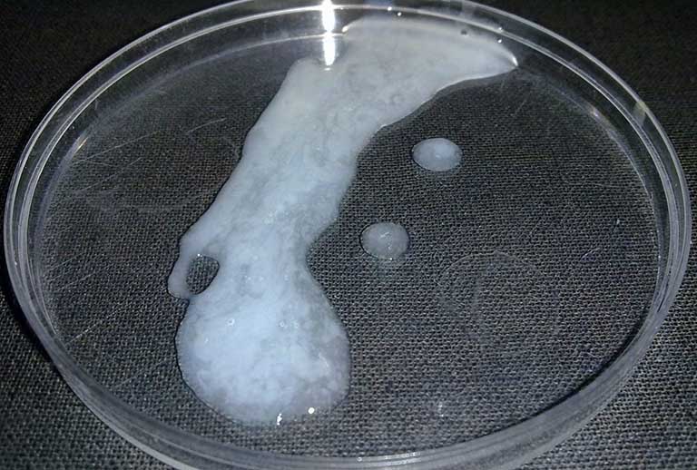 Tinh trùng bình thường: màu sắc, số lượng